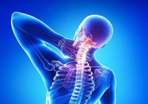Cervical osteochondrosis