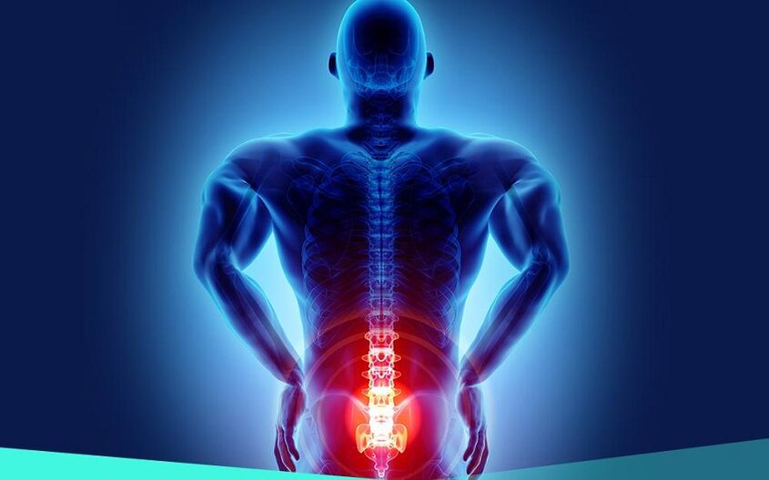 pain due to hip arthrosis